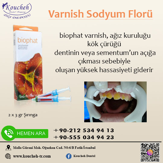 Varnish Sodyum Florü